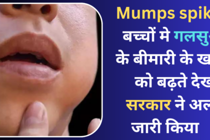 Mumps spikes