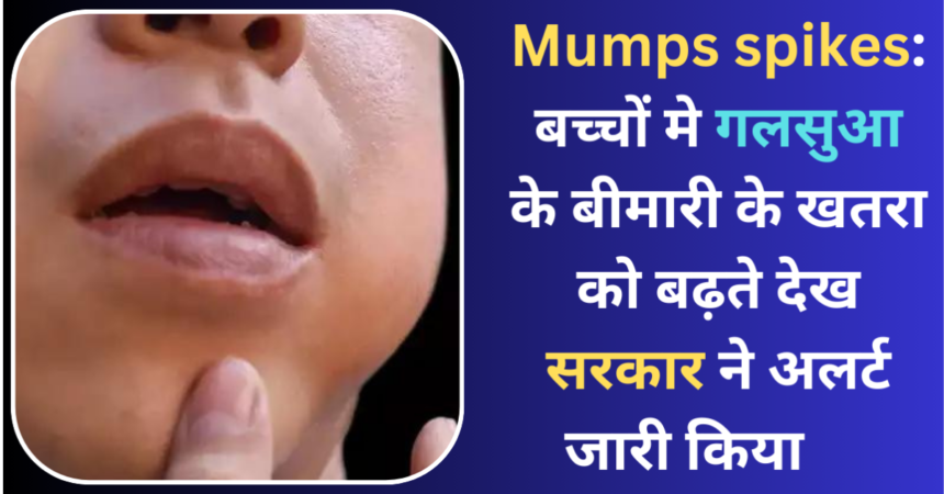 Mumps spikes